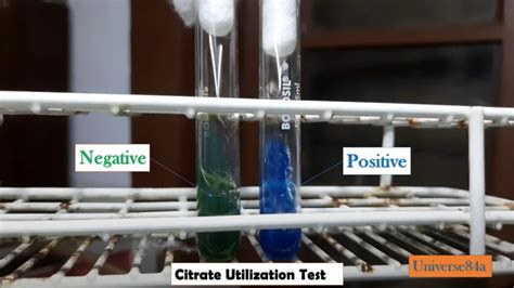 citrate test positive result|Citrate Utilization Test: Introduction Principle, .